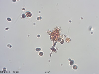 protozoo/Mesodinium sp (1)(copy)_thumb.jpg